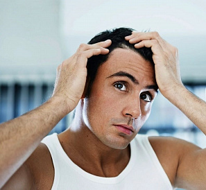 10 best remedies for baldness (alopecia)